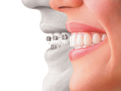 The image shows a split-screen comparison of a person s face with an overlay of a dental implant on one side, highlighting the difference between natural teeth and dental prosthetics.