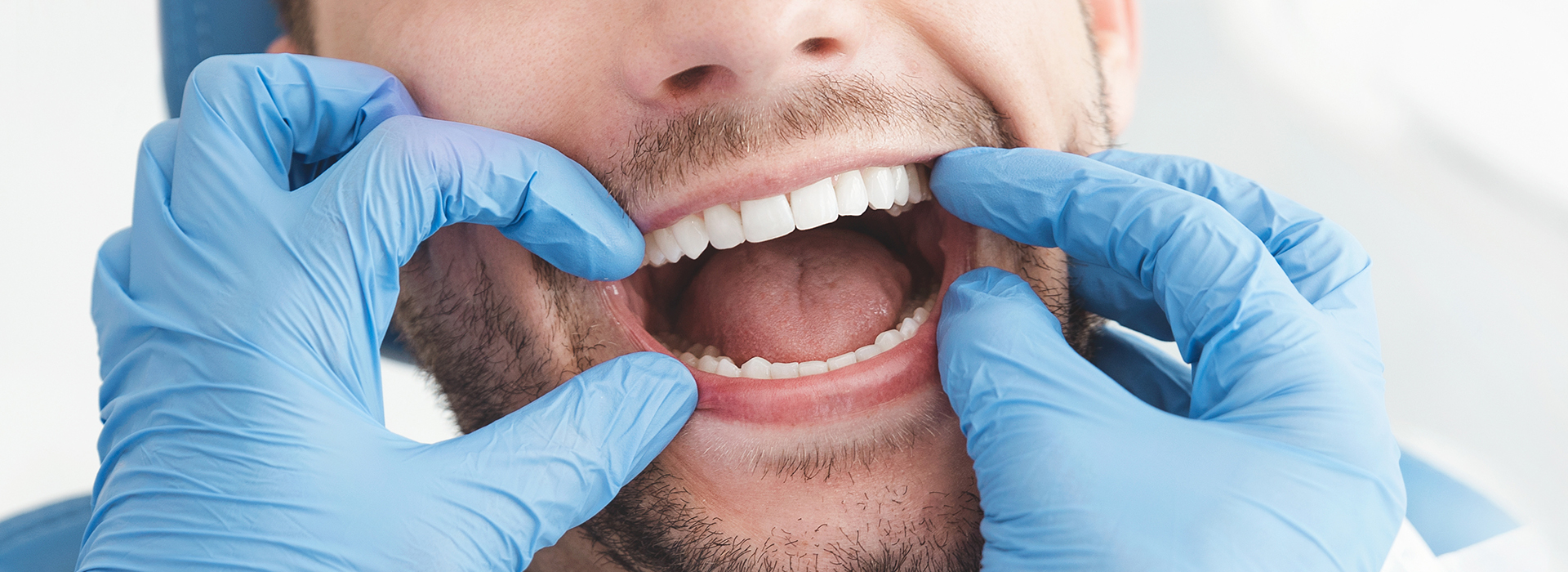 The image shows a man with an open mouth, surrounded by medical equipment such as gloves and a mask, suggesting he may be a dental professional or patient during a dental procedure.